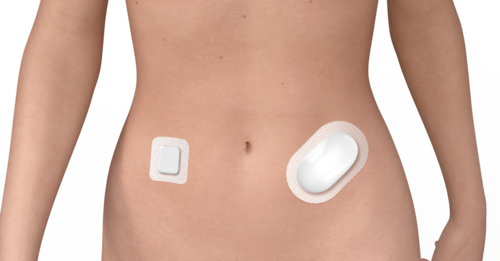 Wearables_bomba de insulina pegada al abdomen.png