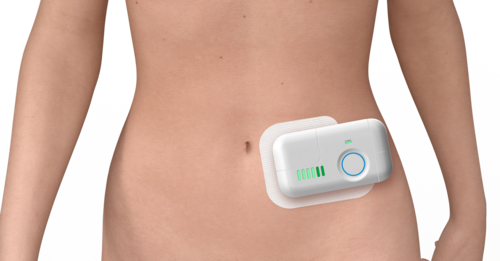 Wearables_Inyector de gran volumen en el abdomen.png